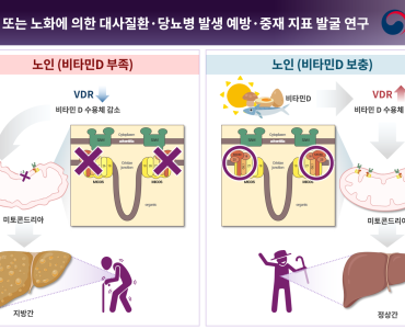 비타민 D, 노인성 지방간 예방의 새로운 희망 이미지